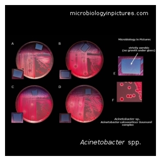 acinetobacter baumannii